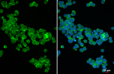 Anti-CD70 antibody [HL6015] used in Immunocytochemistry/ Immunofluorescence (ICC/IF). GTX648089